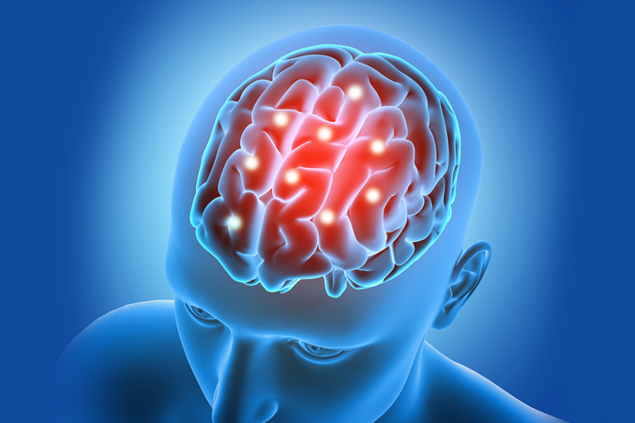 Multiple Sclerosis