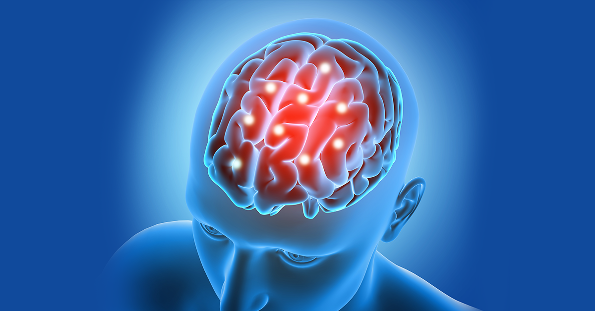 Multiple Sclerosis