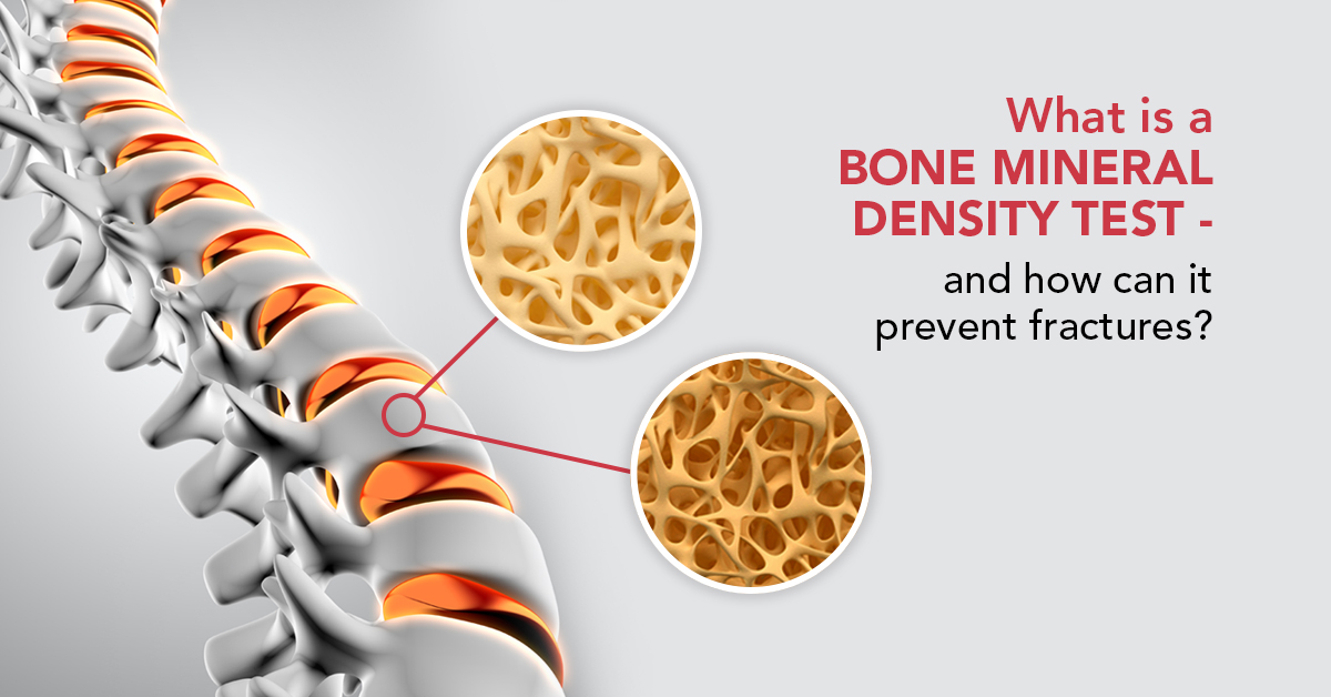 Bone Mineral Density Test