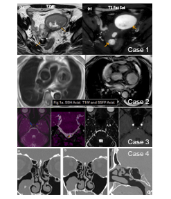 Star Imaging and Research Centre elastograhpy service