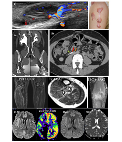 Star Imaging and Research Centre elastograhpy service
