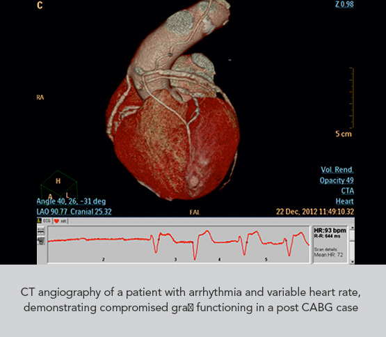 Star Imaging and Research Centre Angiography