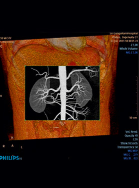 Star Imaging and Research Centre angiography xray