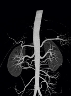 Star Imaging and Research Centre angiography xray