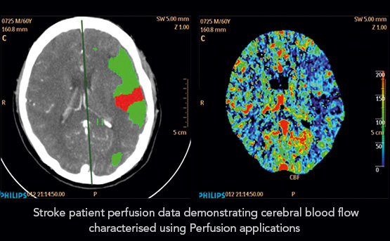 Star Imaging and Research Centre strock patient